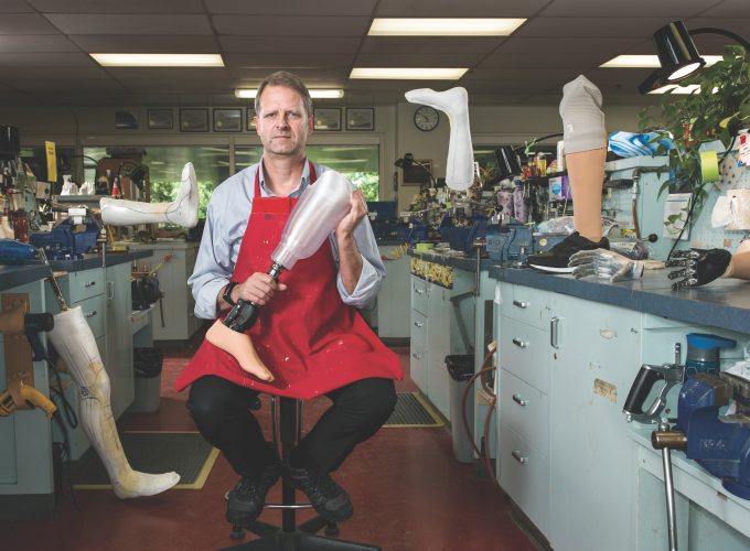 Expert: What I Know About… Prosthetics