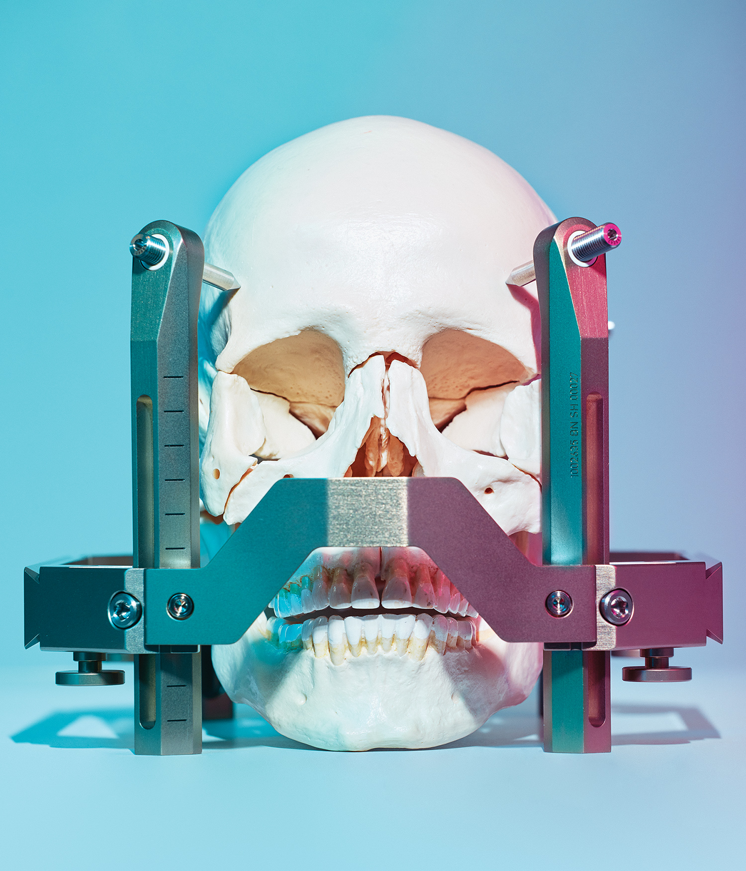 The Gamma Knife targets the human head